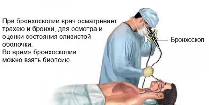 Бронхоскопия какой метод. Бронхоскопия пропедевтика. ригидная бронхоскопия. санационная бронхоскопия. фибробронхоскопия легких подготовка.