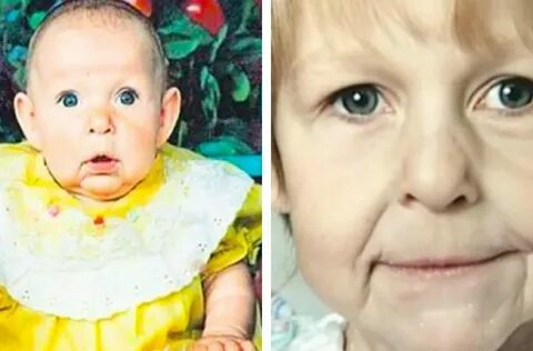 Болезнь родиться старым