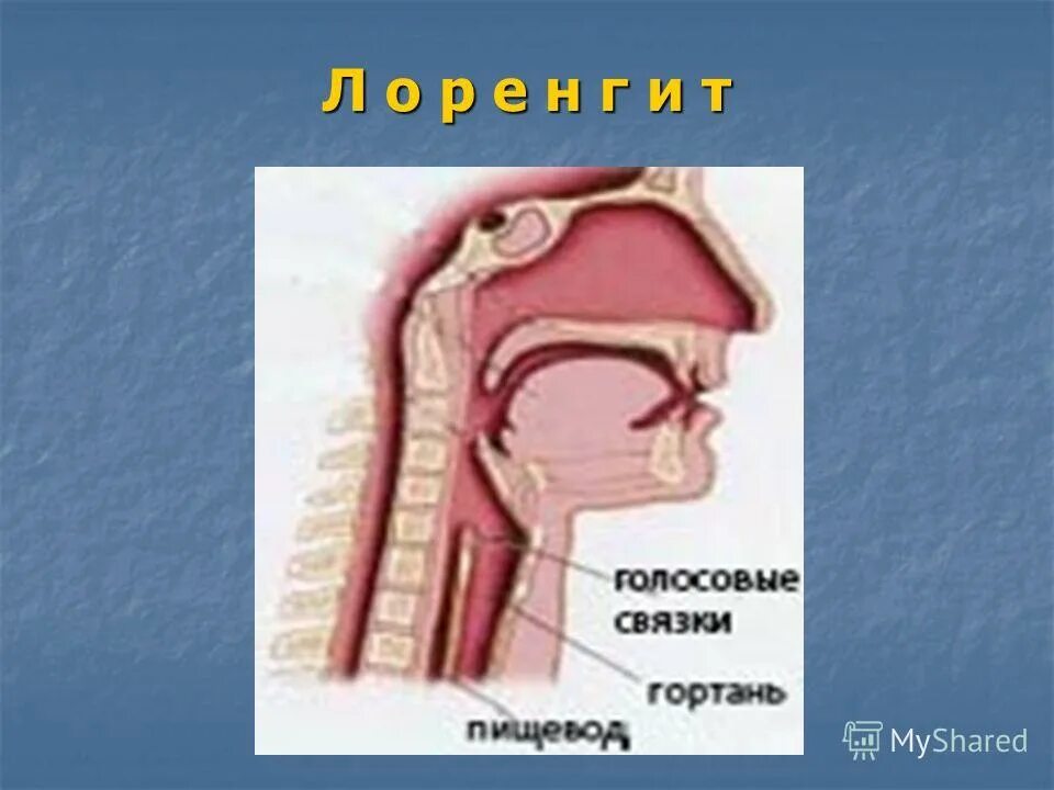 Голосовые связки у человека. Строение голосовых связок. Голосовыесвязку у человека.