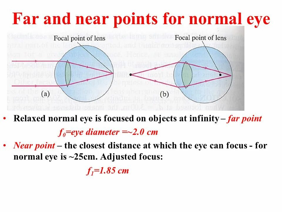 Near & far. Normal points. Accommodation of Eye near far. Far sightedness and near sightedness.