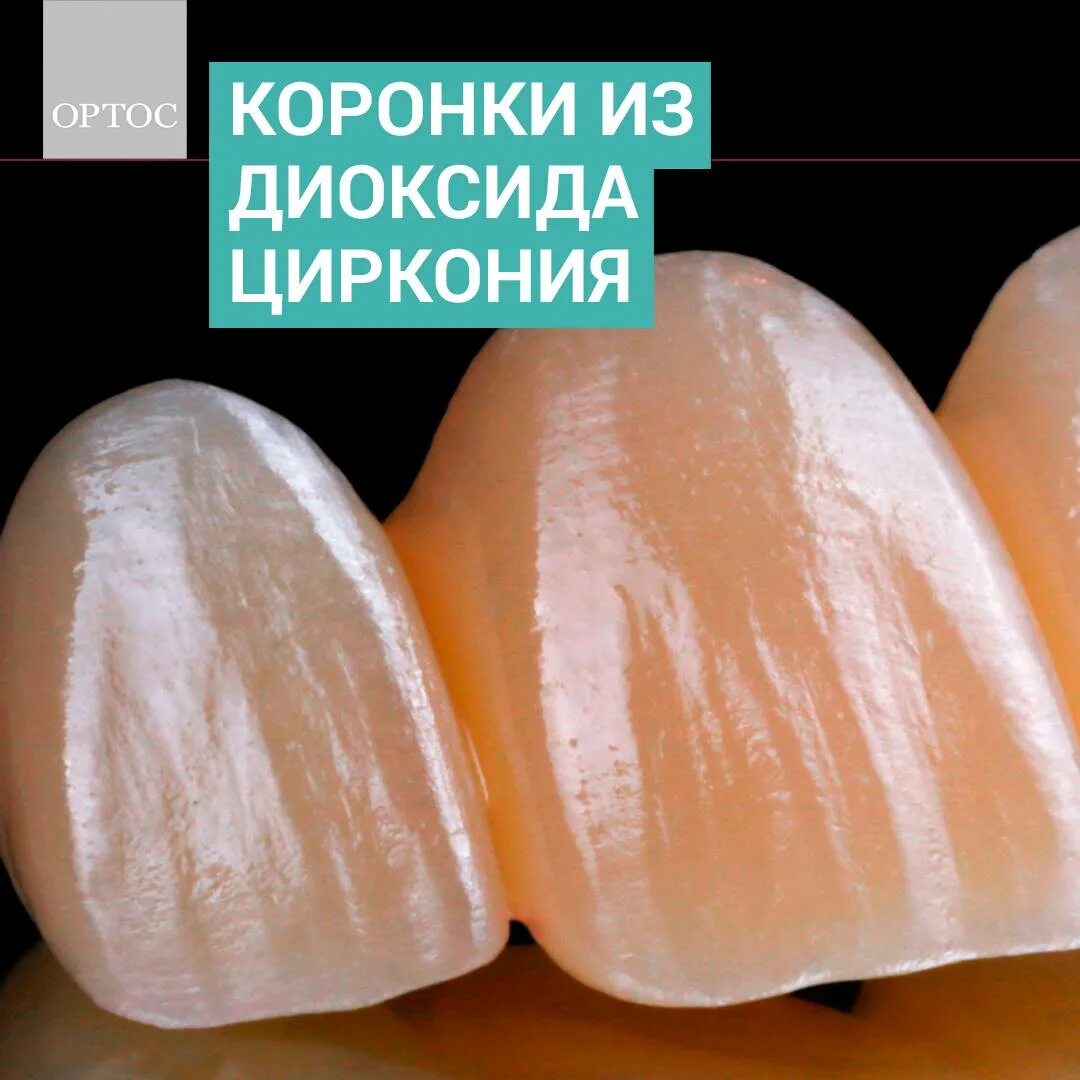 Цирконий зубы плюсы и минусы