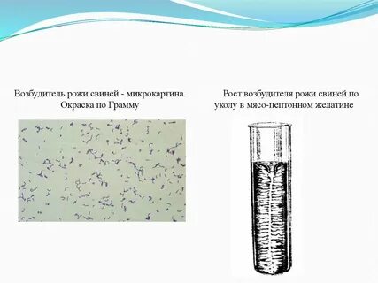 Возбудитель рожи