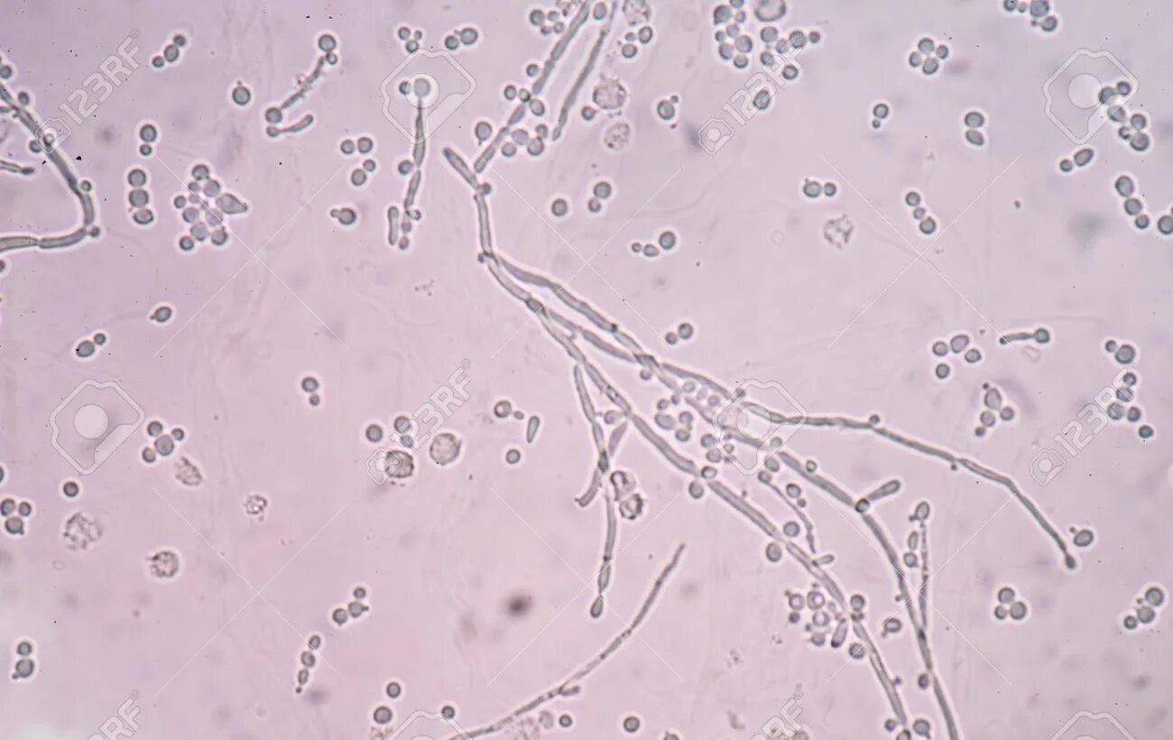 Грибы кандида микроскопия. Мицелий грибов кожи микроскопия. Мицелий грибов в моче микроскопия. Нити мицелия микроскопия. Мицелий грибов у женщин