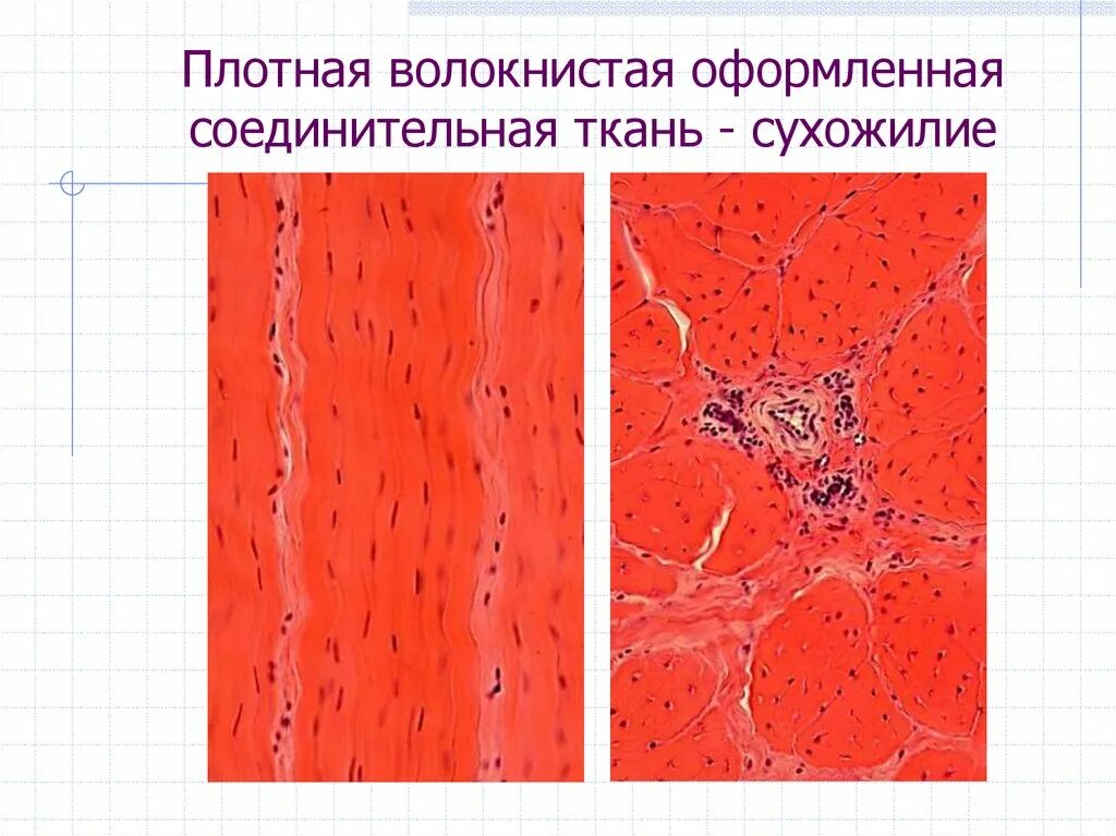 Плотная оформленная ткань. Плотная оформленная волокнистая соединительная ткань. Плотная неоформленная соединительная ткань сухожилия. Плотная неоформленная соединительная ткань микропрепарат. Плотная волокнистая соединительная ткань гистология.