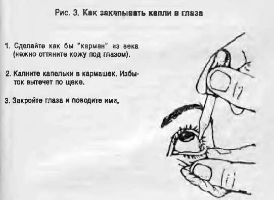 Как правильно закапывать глазные капли самому себе в глаза. Как правильно закапывать глазные капли самому себе. Как закапывать глазные капли ребенку. Как правильно закапать глазные капли самому себе в глаза видео.