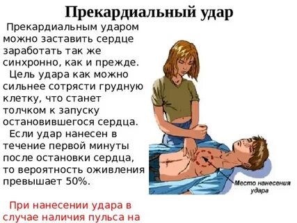 Нанесение прекардиального удара в область грудины