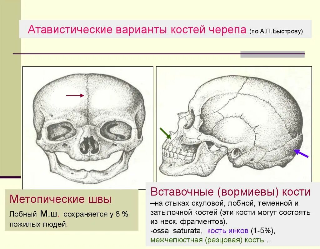Черепная аномалия. Кости и швы черепа анатомия. Метопический шов костей черепа. Лобный шов черепа анатомия. Кости черепа лобный шов.
