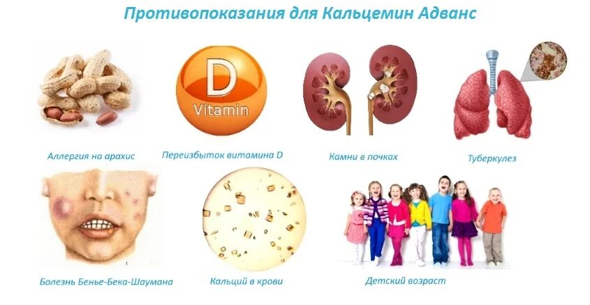 Реакция на витамин д. Аллергическая реакция на витамин д. Аллергическая реакция на витамин с.