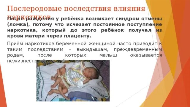 Абстинентный синдром у новорожденных. Неонатальный абстинентный синдром. Синдром отмены у новорожденных. Синдром отмены у новорожденных. Синдромы у новорожденных детей.