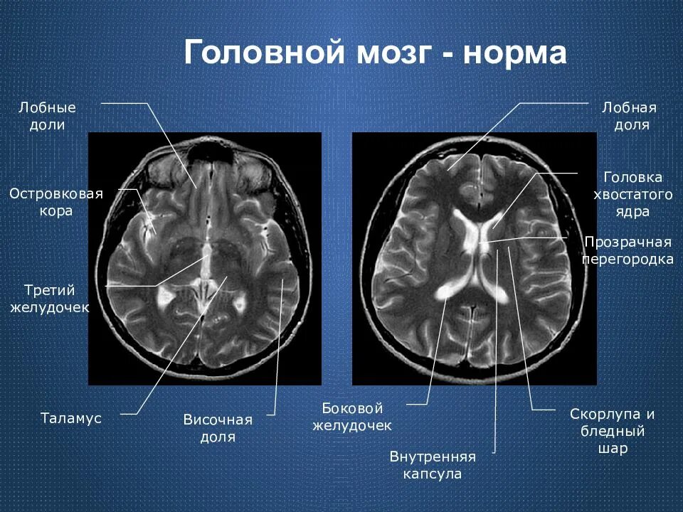 Мозг у плода норма