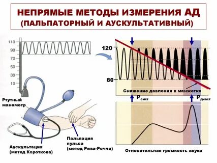 Аускультативный метод давления