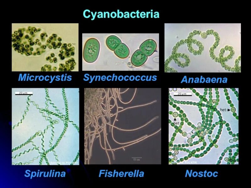 Цианобактерии ANABAENAANABAENA:. Синезелёные водоросли цианобактерии. Носток цианобактерия. Носток и Анабена. Группы организмов цианобактерии