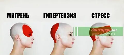 Головная боль в течении недели