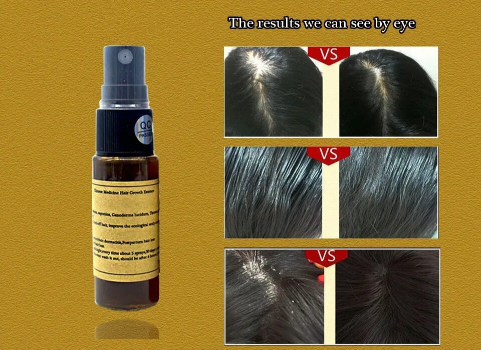 Сильный рост волос. Сыворотка для роста волос hair growth Serums. Китайская сыворотка для волос. Для роста волос китайское. Масло для роста волос Китай.