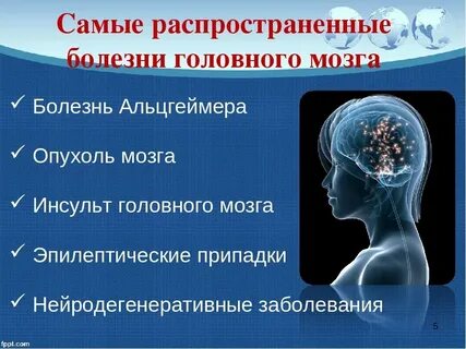 Болезнь головной боли как называется