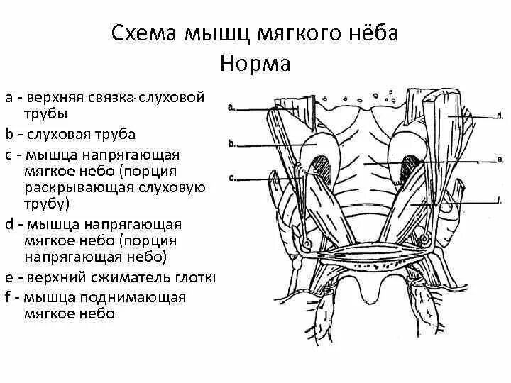 Поднятие мягкого неба. Мышцы мягкого неба схема. Мышца напрягающая небную занавеску. Мышца поднимающая мягкое небо. Мышцы мягкого неба анатомия.