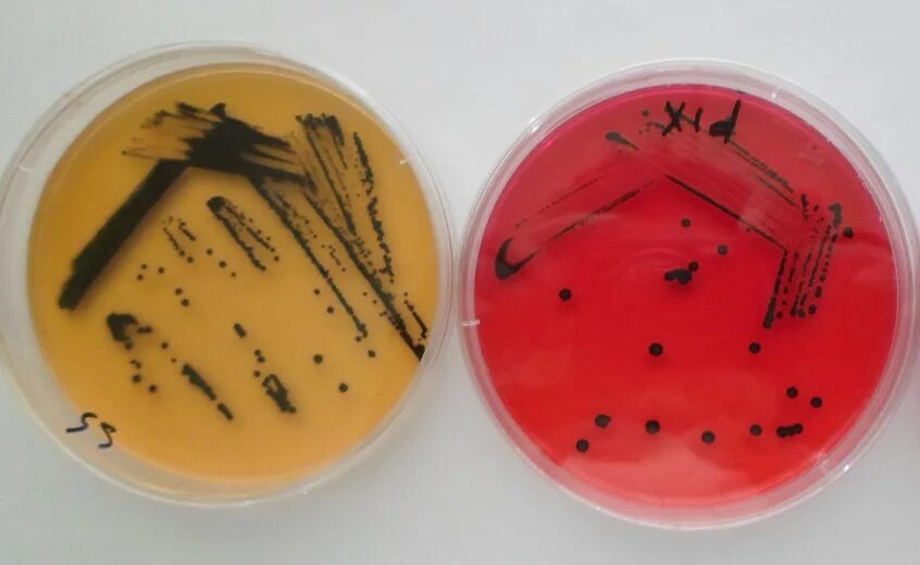 Spp salmonella spp shigella spp