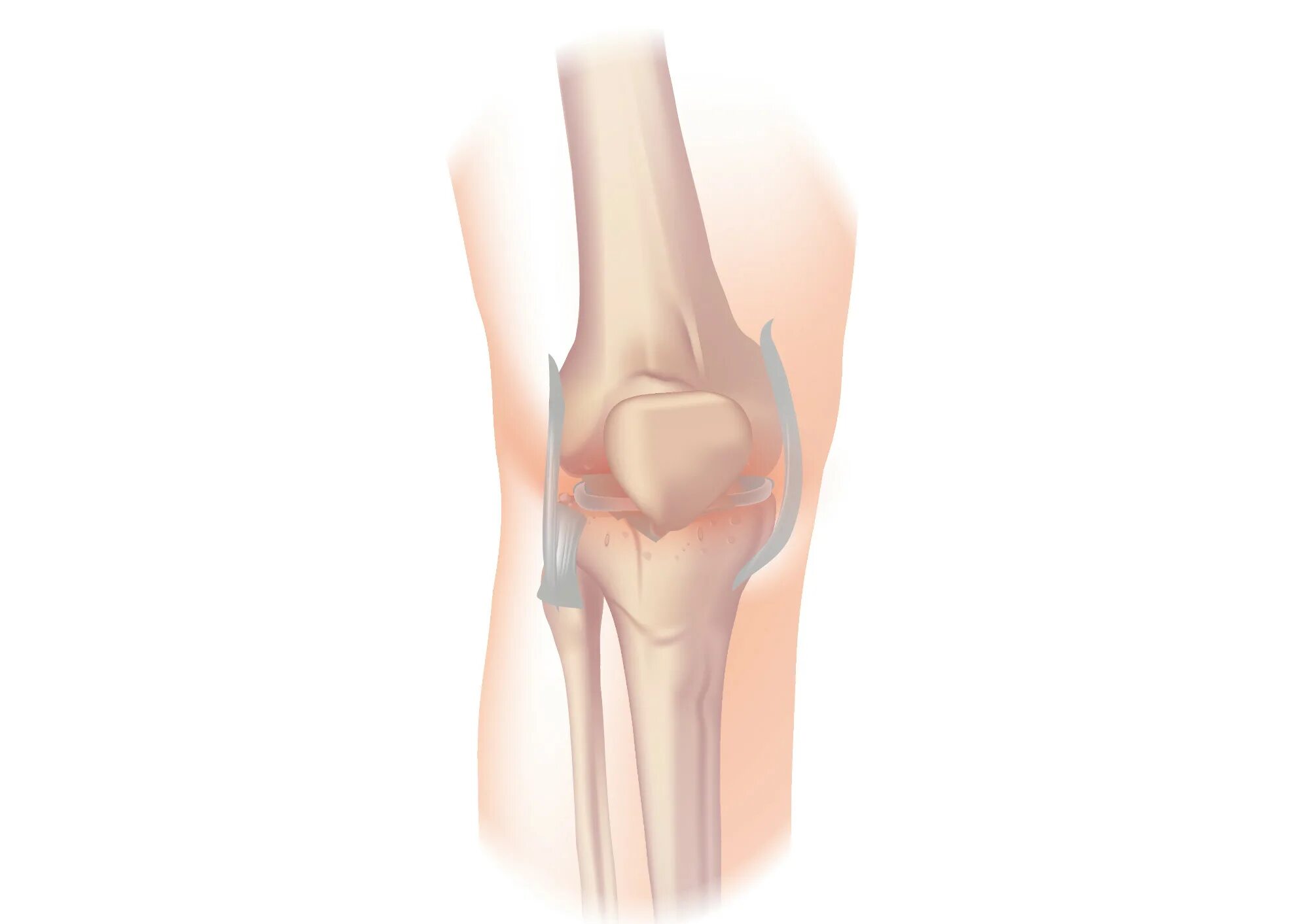 Колена ли. Коленный сустав без фона. Больное колено. Источник артрит коленного сустава.