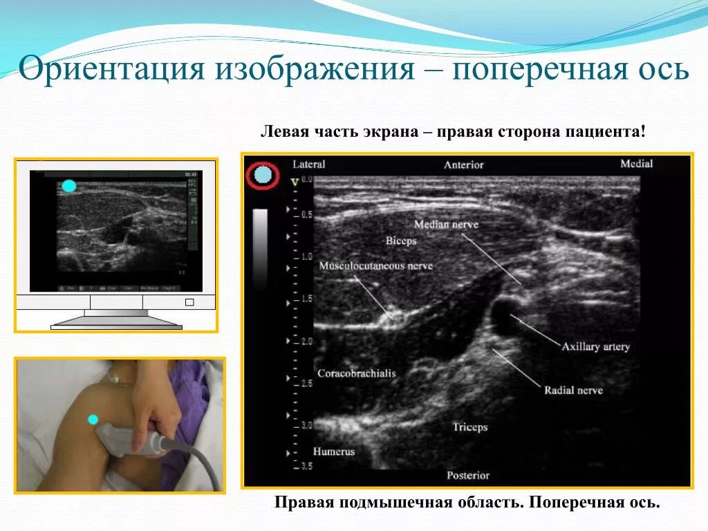 Экран правее. Ориентация изображения. Ориентация фотографии. УЗИ основы для начинающих. УЗИ на экране правая и левая сторона.