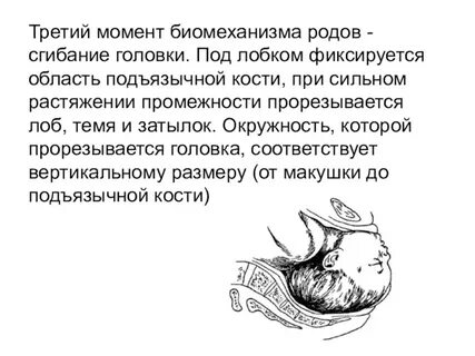 Предлежание головки