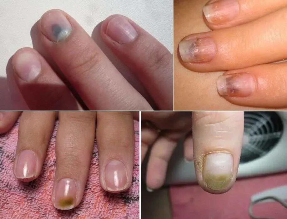 Стало быстро темнеть и теперь это