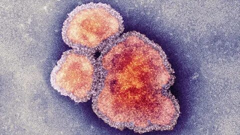 Rubella virus