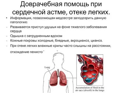 Вода в легких симптомы