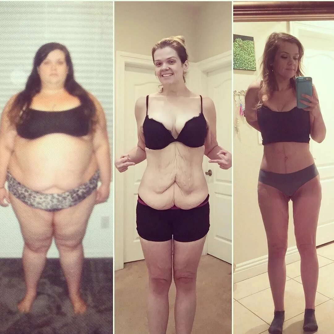 Похудение до и после. Iuдо и после похудения. Полные девушки до и после. Вес до и после похудения.