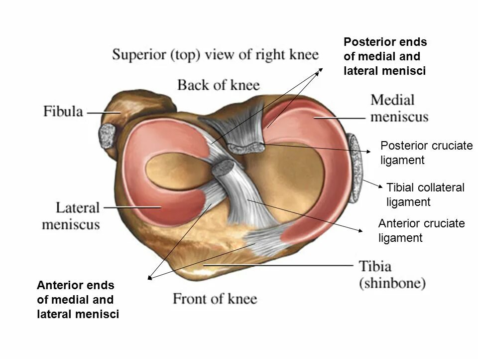 Медиальный мениск коленного сустава анатомия. Менископатия медиального мениска. Внутренний медиальный мениск. Анатомия латерального мениска коленного сустава.