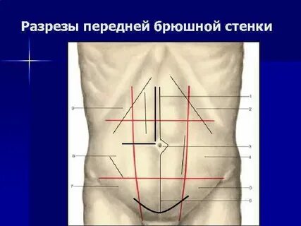 Передняя брюшная