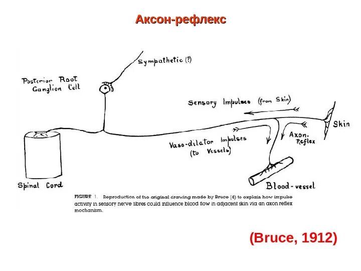 Аксон рефлекс. Аксон рефлекс физиология. Механизм Аксон рефлекса. Аксон рефлекс схема. Аксон рефлекс физиология схема.