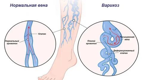 От вен сосуды