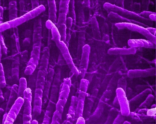 Clostridium spp. Клостридия диффициле микроскопия. С novyi клостридии.