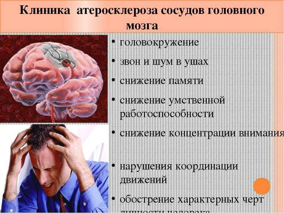 Болезнь заболевание мозга. Атеросклероз сосудов головного мозга. Атеросклероз артерий головного мозга. Клинические проявления атеросклероза мозговых артерий. Атеросклероз сосудов головного мозга симптомы.