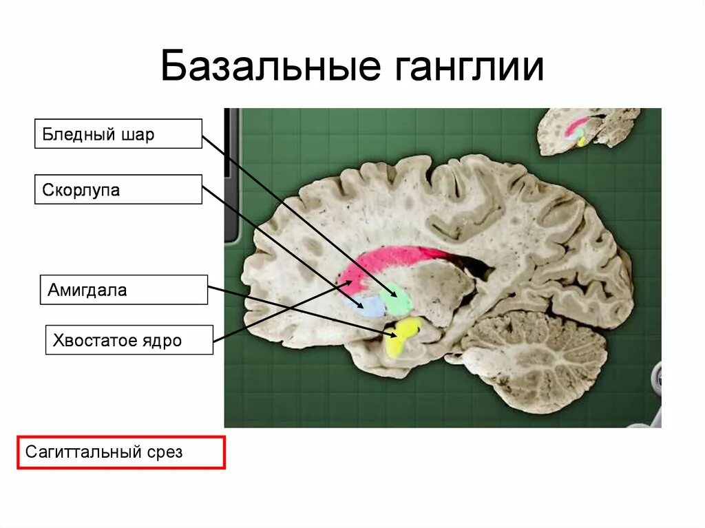 Базальные ганглии головного мозга. Базальные ганглии головного мозга анатомия. Хвостатое ядро базальных ганглиев. Базальные ганглии конечного мозга. Изменение в базальных отделах