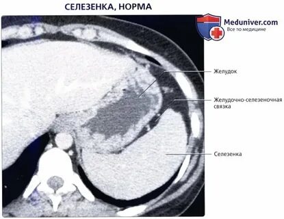 Селезенка нормальная
