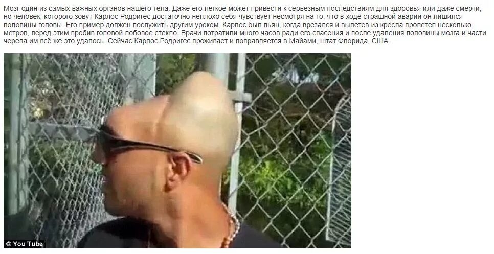 Майами карлос родригес. Человек прожил без головы. Человек прожил без головы. Человек прожил без головы. Карлос родригес пол головы.
