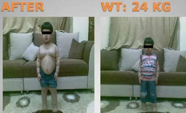 Пацан после операции. Пацан после операции. Пацан после операции. Молодые люди в больнице. Пацан после операции.