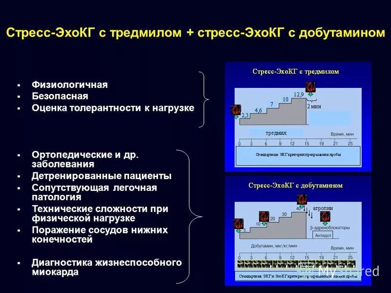 Стресс с добутамином. Стресс ЭХОКГ С добутамином. Стресс Эхо крадиография с добутамином. Стресс-эхокардиография / стресс ЭХОКГ (С добутамином. Критерии положительного стресс ЭХОКГ.