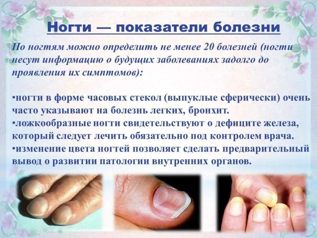 Почему меняется ноготь