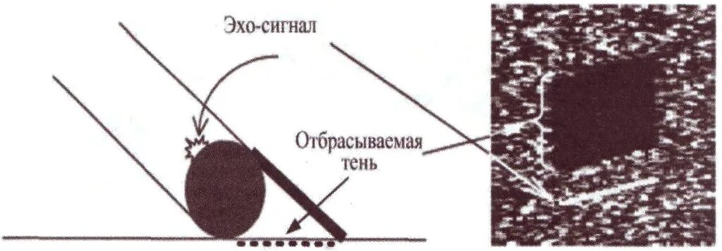 Эхо сигнал