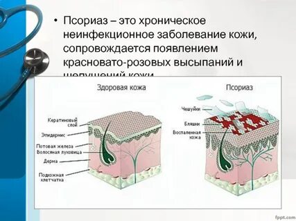 Показания при псориазе