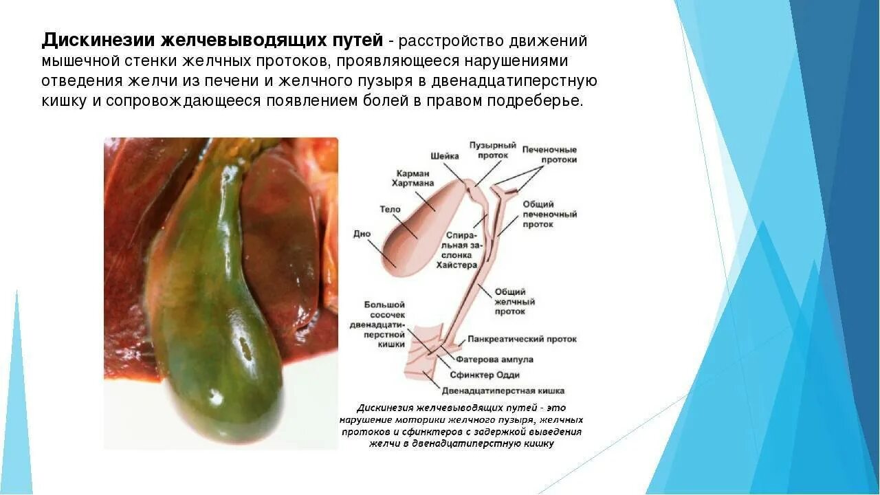 Симптомы плохой желчи. Функциональные нарушения желчевыводящих путей. Дискинезия желчевыводящих путей спазм. Дискинезия желчного пузыря симптомы. Симптом гиперкинезии желчного пузыря:.