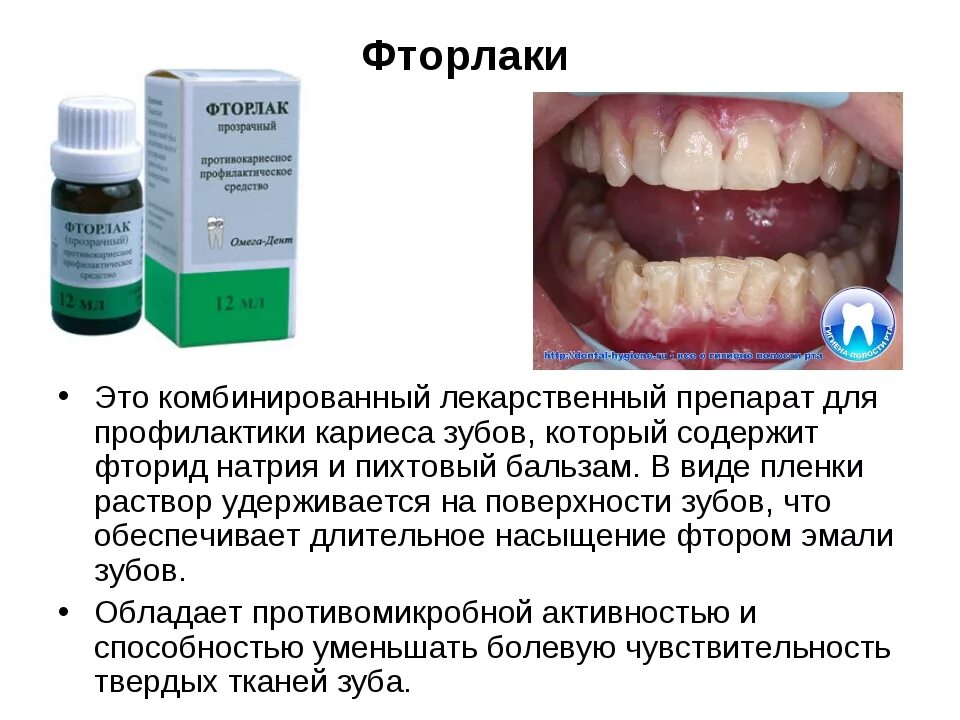 Фтор лаком. Фторлак для зубов. Фторлак в стоматологии. Фторирование зубов фторлаком. Покрытие зубов фторсодержащим лаком.