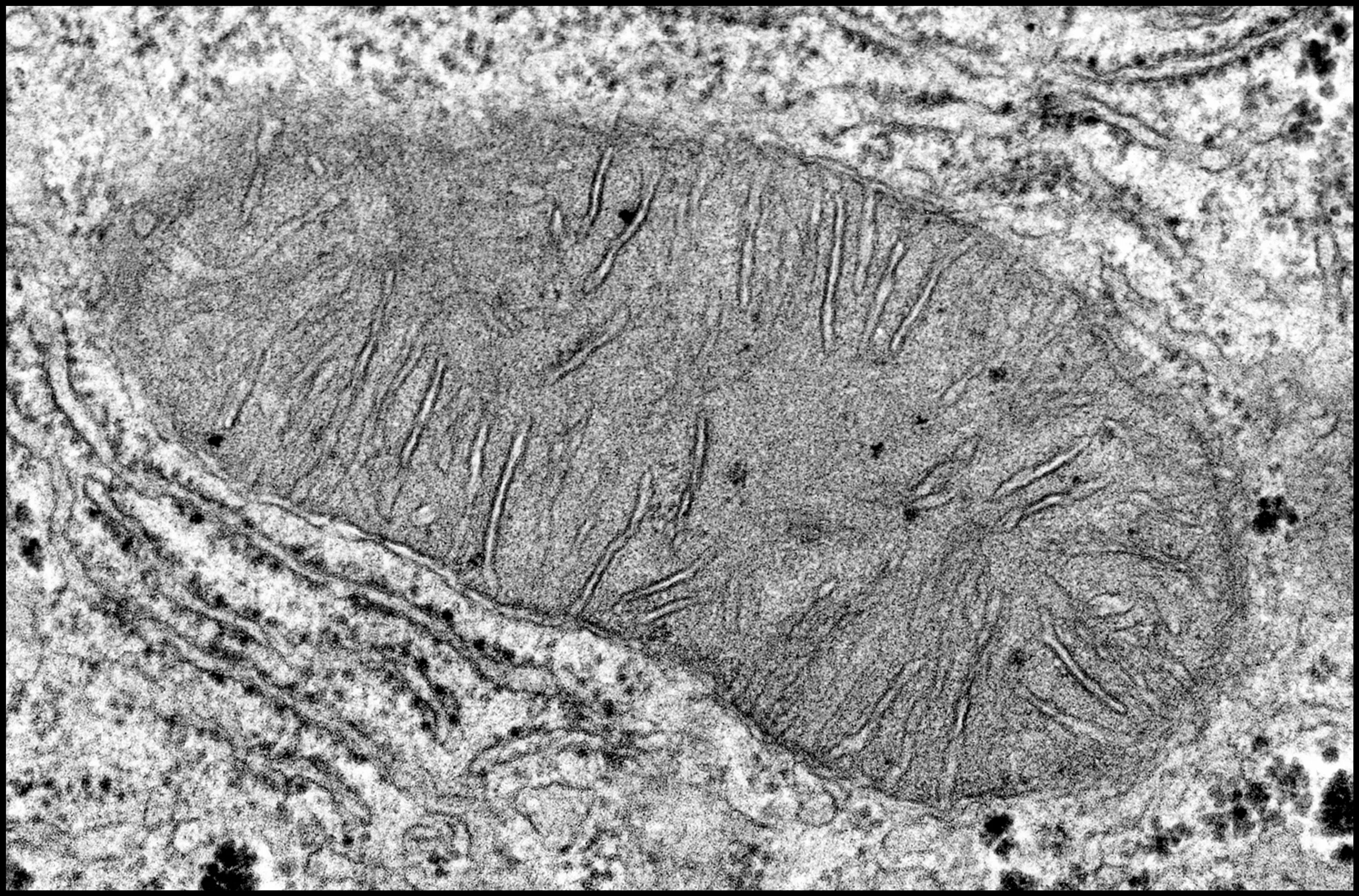 Митохондрии в клетках печени. Микрофотографии органоидов клетки. Митохондрия микрофотография. Электронограммы клетки с органеллами. Электронограмма митохондрии.