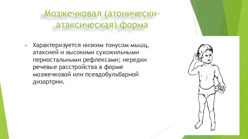 Синдром мозжечковой атаксии