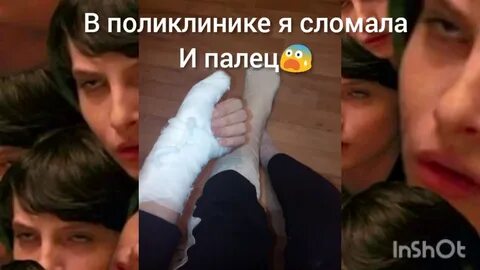 Мама сломала ногу