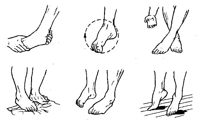 Гимнастика после инсульта для лежачих. Гимнастика после перелома лодыжки. Реабилитация ног после инсульта. Лечебная физкультура при парезе нижних конечностей. Как разработать ногу после инсульта.