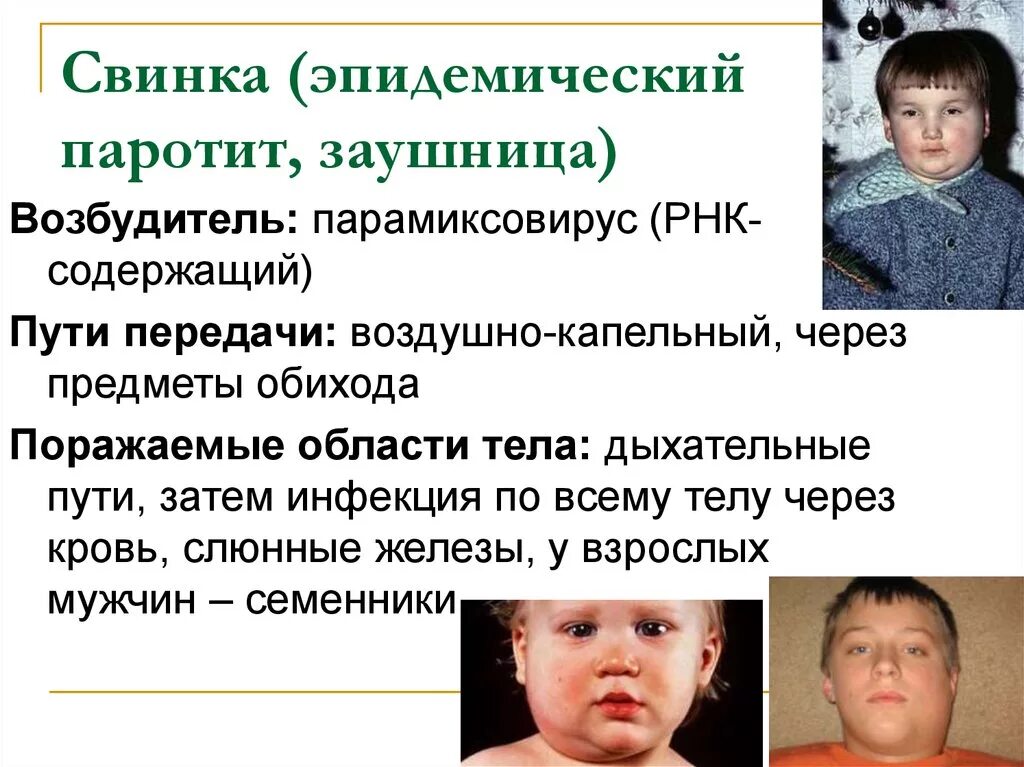 Как передается свинка
