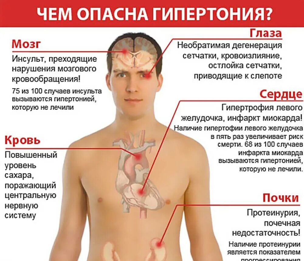 Причины болезни кровообращения. Гипертония симптомы. Артериальная гипертензия симптомы. Чем опасно повышение артериального давления. Гипертоническая болезнь симптомы.